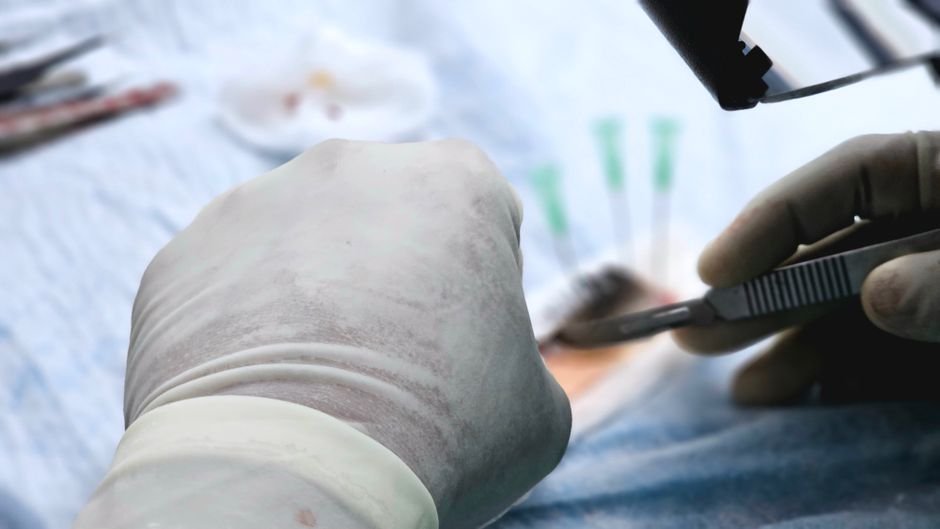 UK Health Body Backs NHS Funding For Liver Perfusion Device